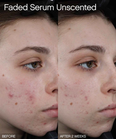 topicals faded serum for dark spots & discoloration