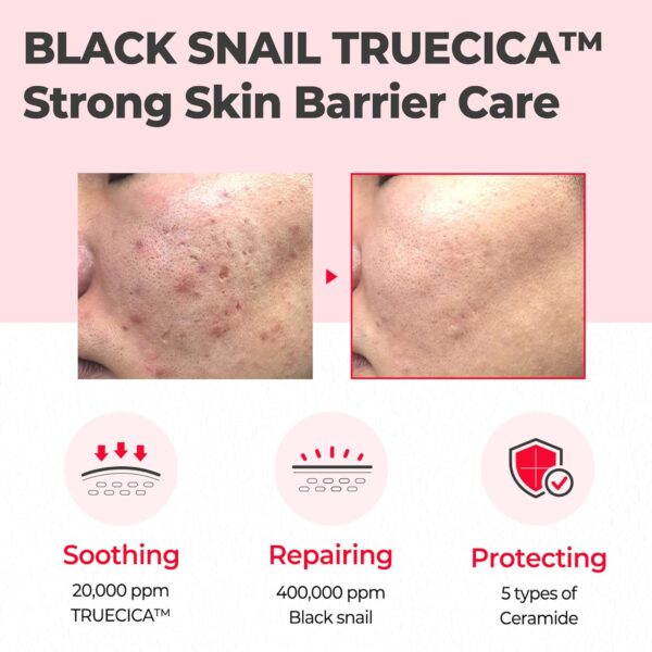some by mi – snail truecica miracle repair cream 60gr