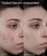 Topicals  Faded Serum for Dark Spots & Discoloration - Image 3