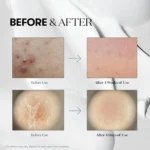 VT Cosmetics Reedle Shot 300 - Image 3