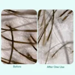 Nutrafol Root Purifier Shampoo 240ml - Image 2