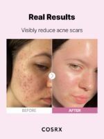 COSRX The Niacinamide 15 Serum - Image 2